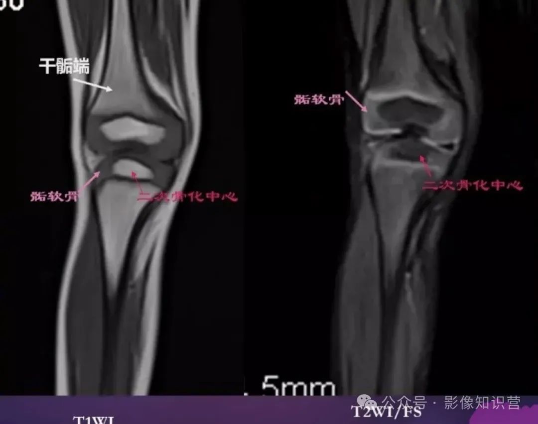 四肢骨骼影像解剖，一文掌握！