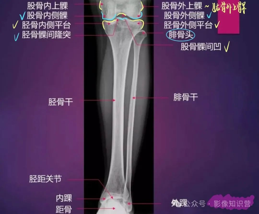 四肢骨骼影像解剖，一文掌握！