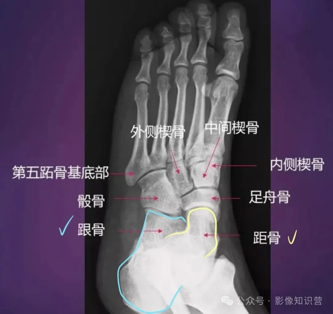 四肢骨骼影像解剖，一文掌握！