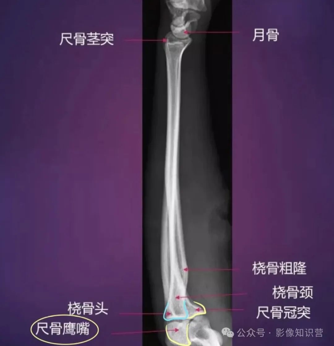 四肢骨骼影像解剖，一文掌握！