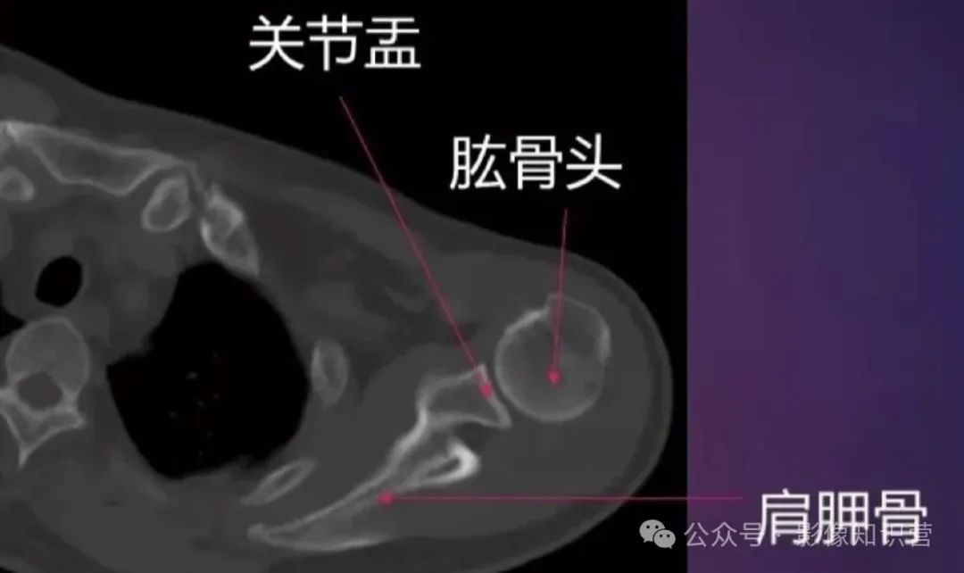 四肢骨骼影像解剖，一文掌握！