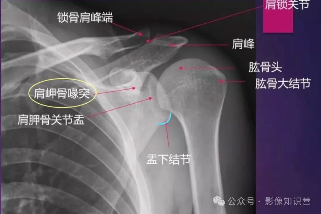 四肢骨骼影像解剖，一文掌握！