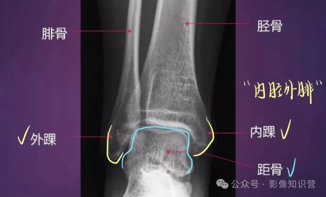 四肢骨骼影像解剖，一文掌握！