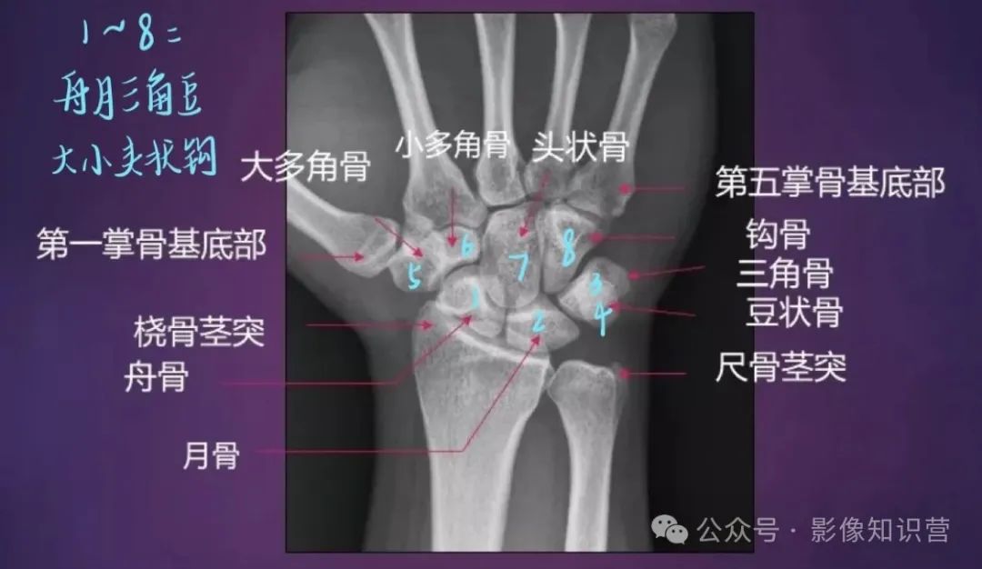 四肢骨骼影像解剖，一文掌握！