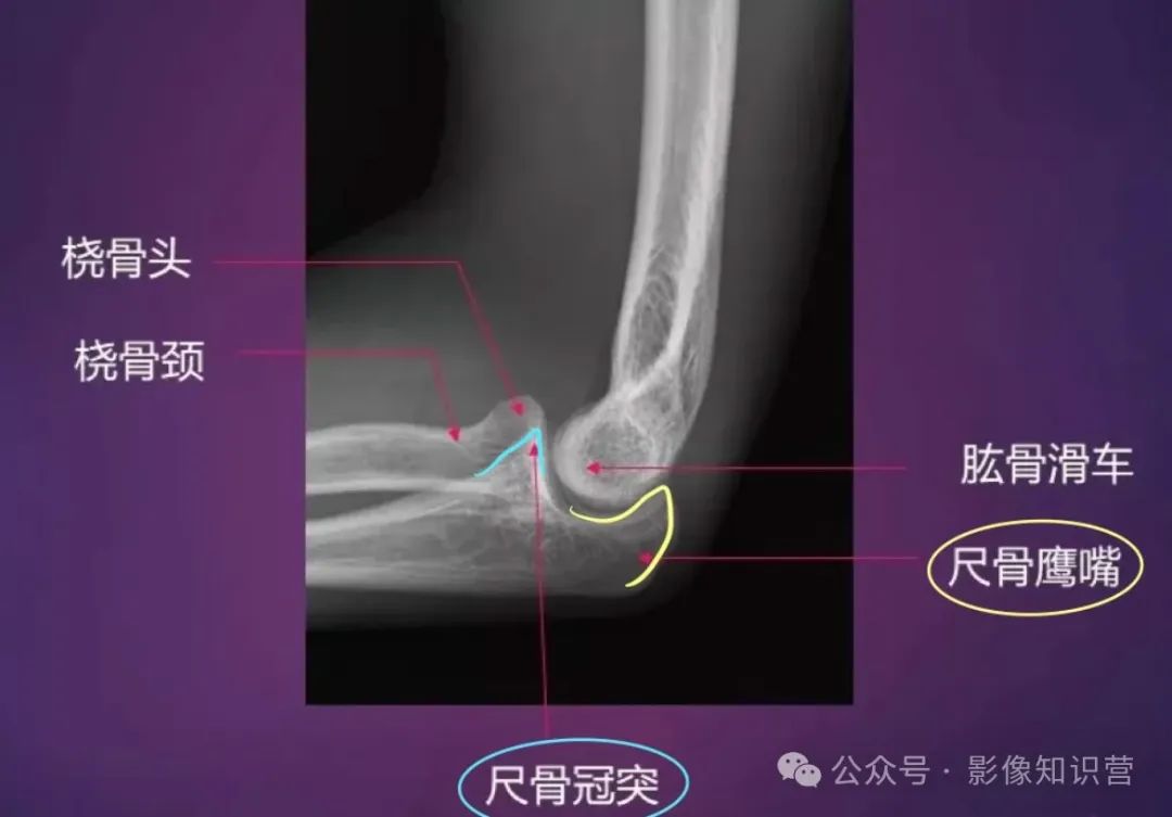 四肢骨骼影像解剖，一文掌握！