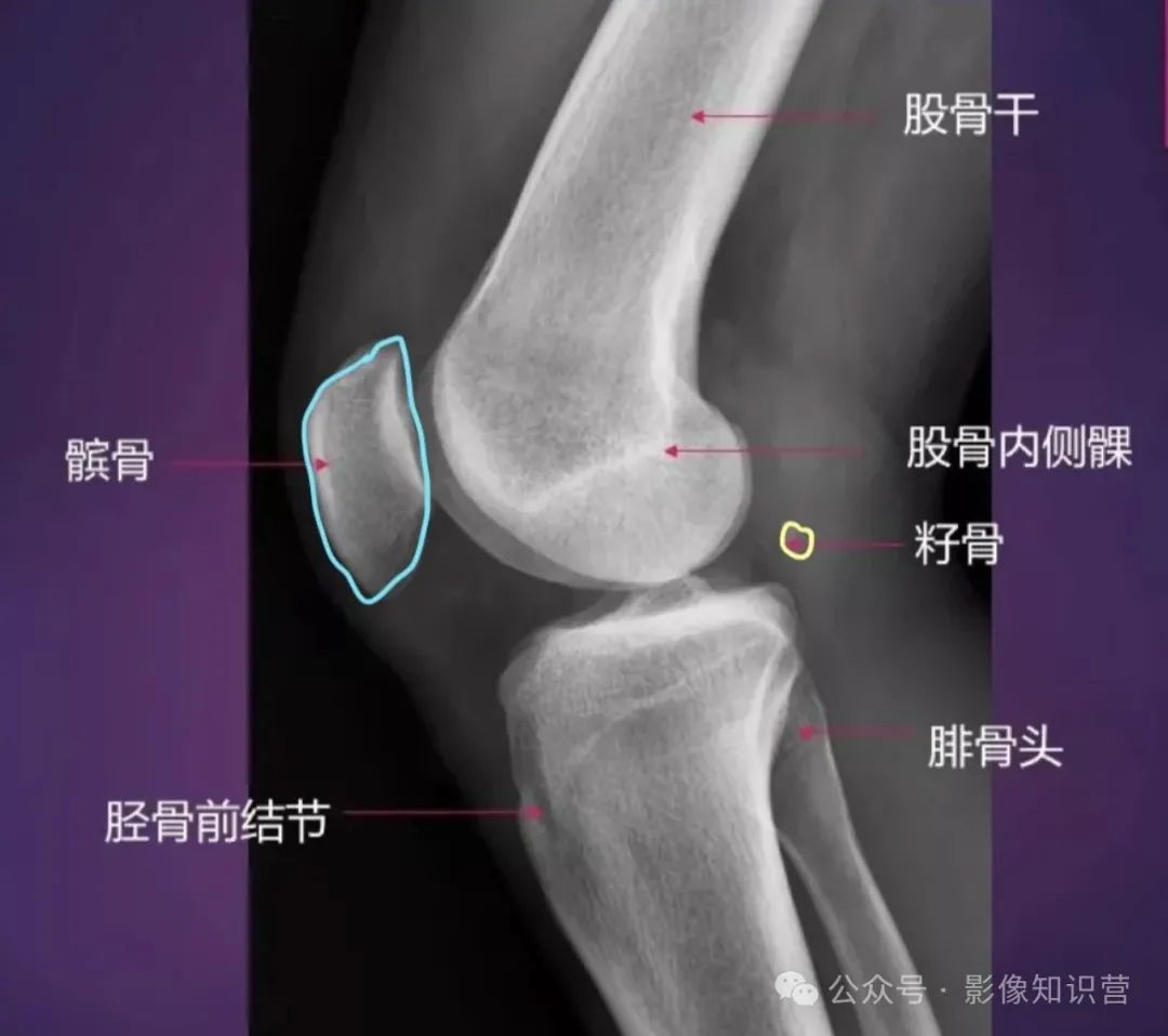 四肢骨骼影像解剖，一文掌握！