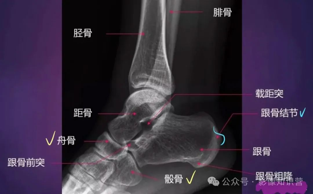 四肢骨骼影像解剖，一文掌握！