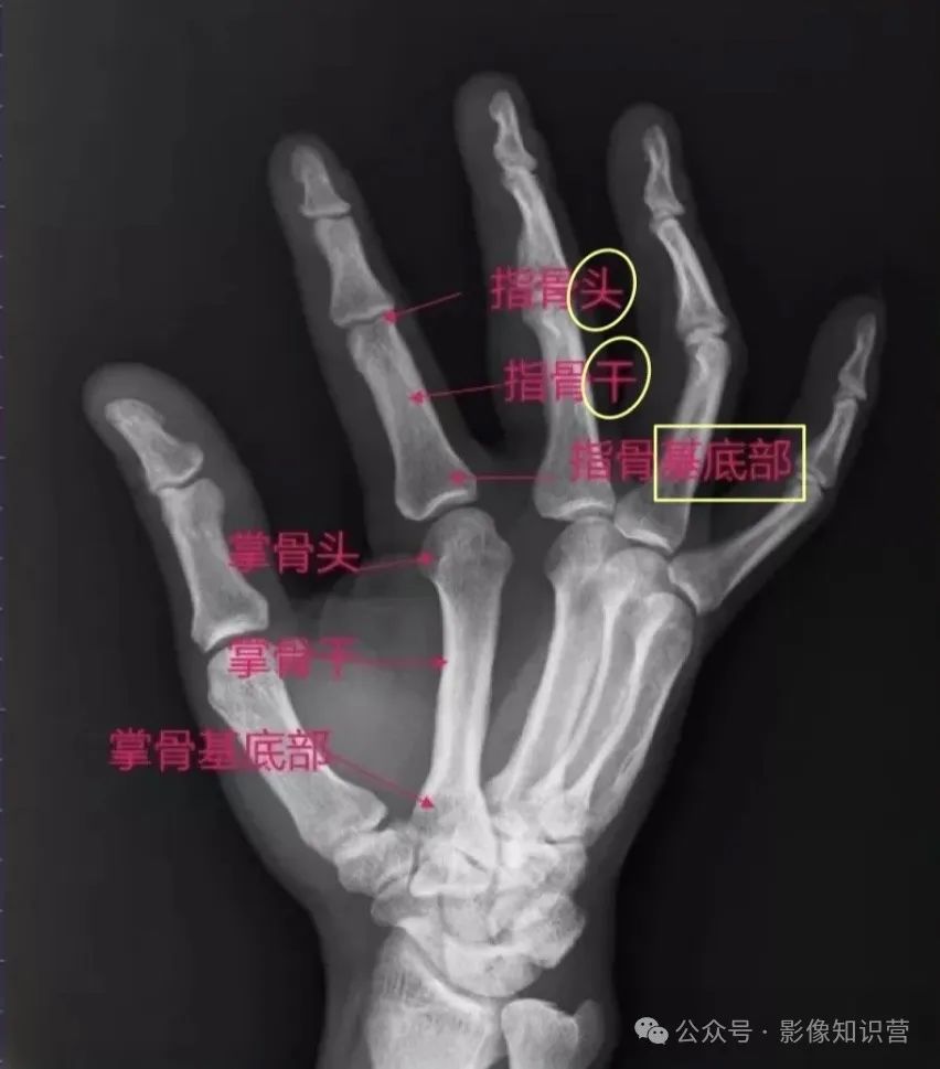 四肢骨骼影像解剖，一文掌握！