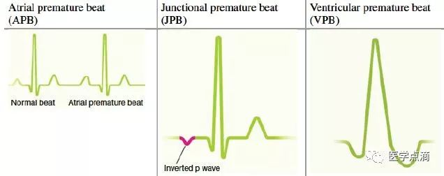心电图总是记不住？这些基础知识一定要掌握！