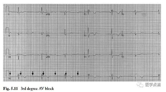 心电图总是记不住？这些基础知识一定要掌握！