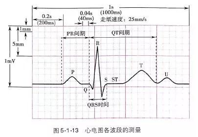 心电图总是记不住？这些基础知识一定要掌握！