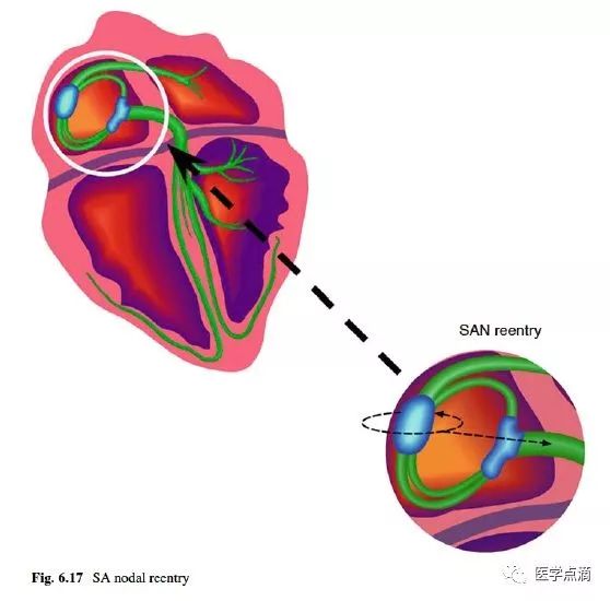 心电图总是记不住？这些基础知识一定要掌握！