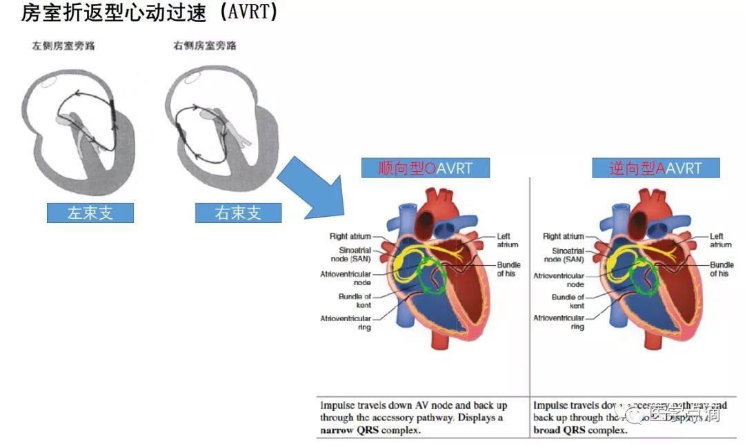心电图总是记不住？这些基础知识一定要掌握！