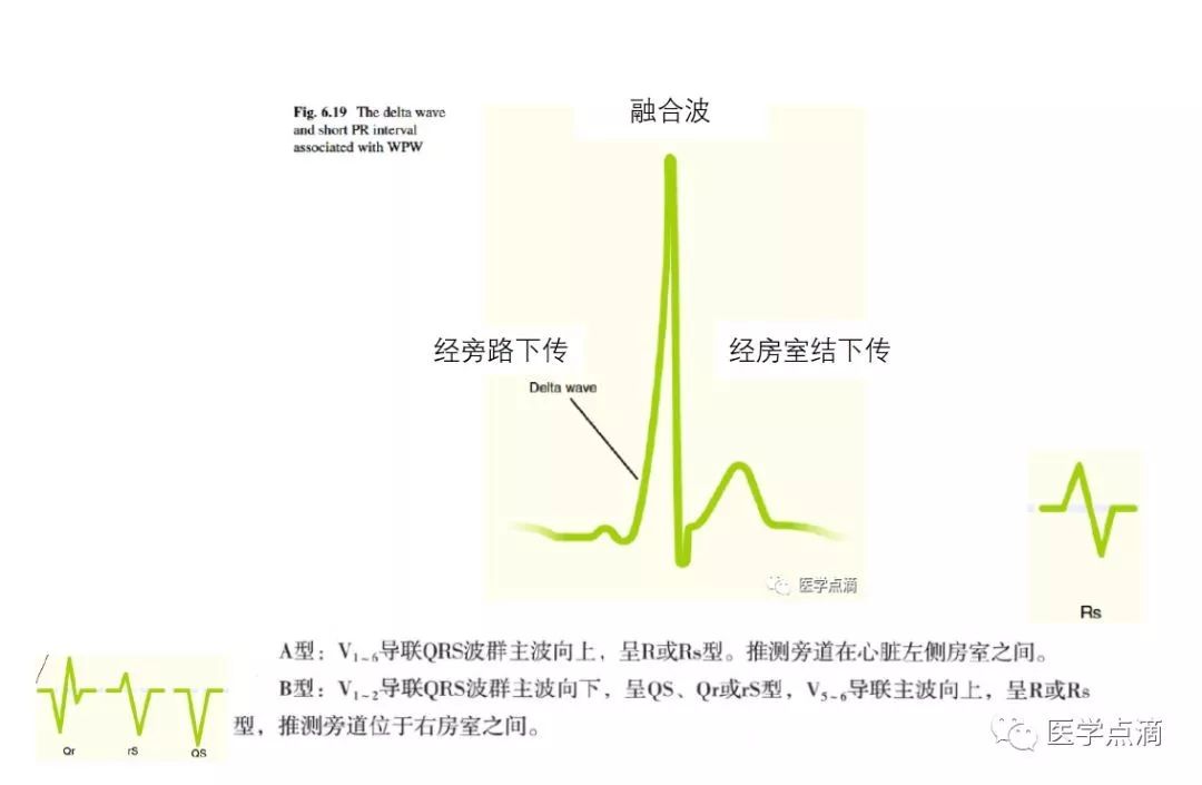 心电图总是记不住？这些基础知识一定要掌握！