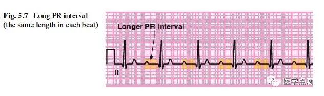 心电图总是记不住？这些基础知识一定要掌握！