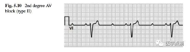 心电图总是记不住？这些基础知识一定要掌握！