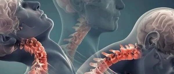 一觉醒来落枕了，怎么办？千万别乱按，正确的做法是......