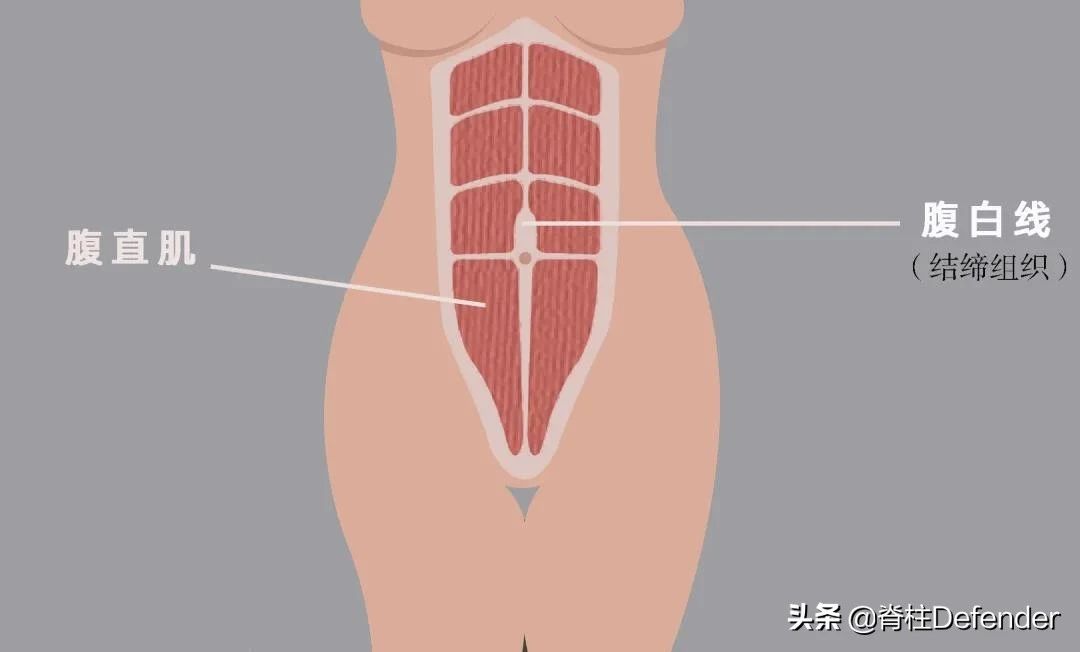 怎样锻炼腹直肌