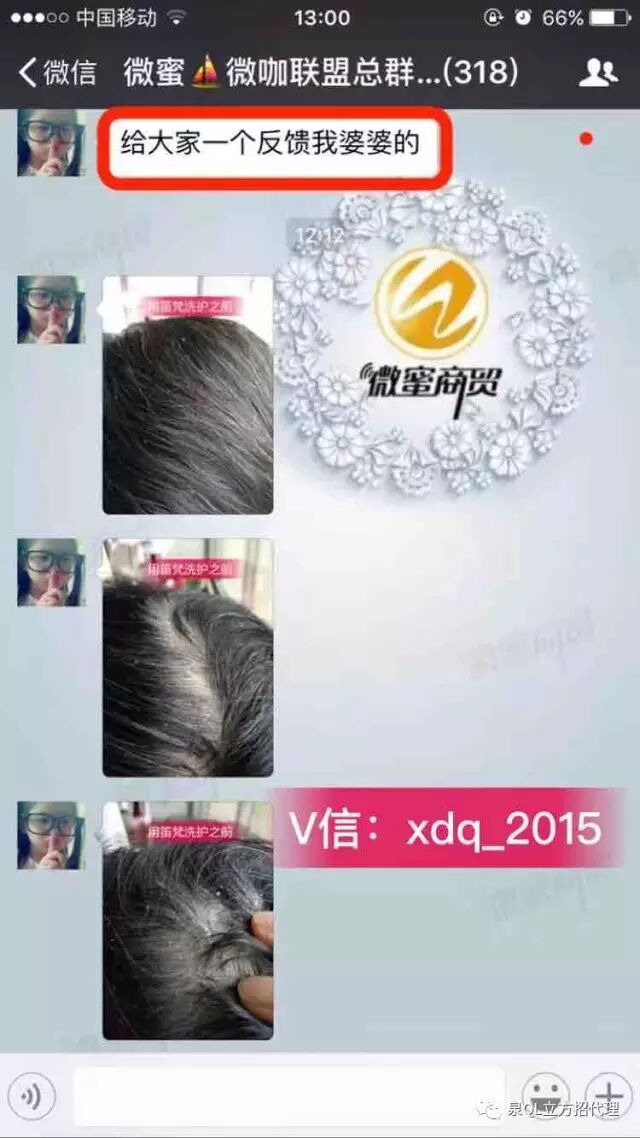 头屑是什么原因造成的？脱发用什么洗发水？笛梵洗护怎么代理