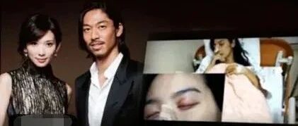 为了什么！46岁林志玲手术后首露面：远嫁日本后，她到底经历了多少心酸？