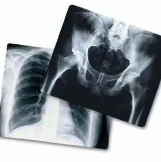 cover_image