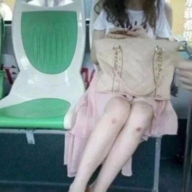 骨科专家：它比跑步更毁膝盖！危害极大，你却天天在做...