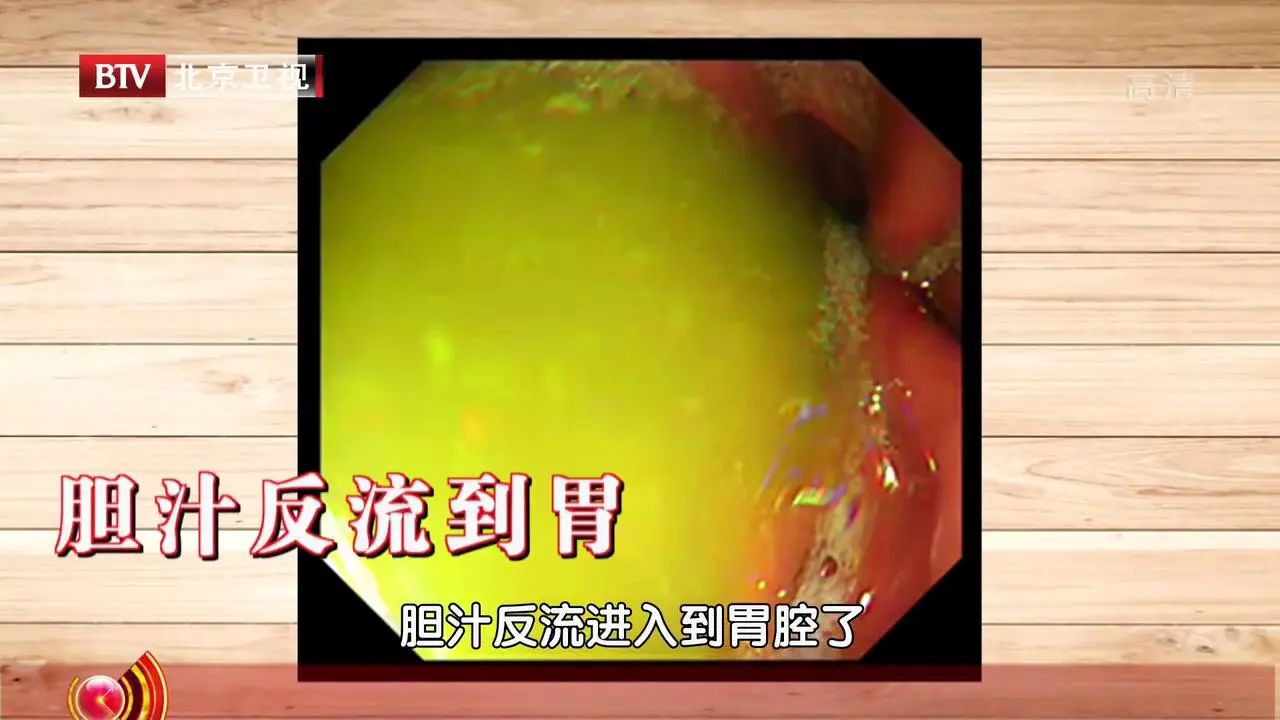 胃带红颜色是什么原因