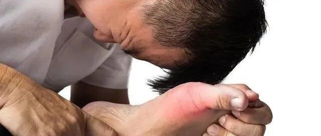 “嘌呤大户”被揪出，宁愿不吃，也别碰这些食物！有你爱吃的吗？