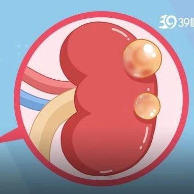 腰痛无力？当心肾脏长了这种异物，直径可达10cm！