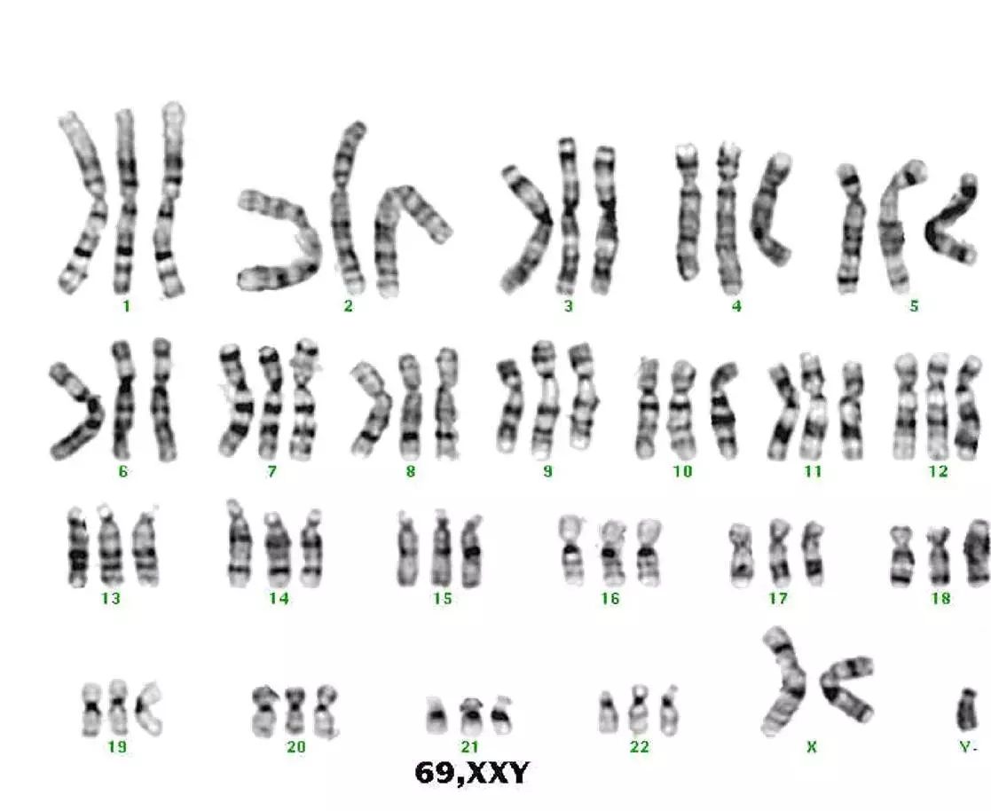 基因家族特征分析 - 染色体定位分析_tbtools染色体定位-程序员宅基地 - 程序员宅基地