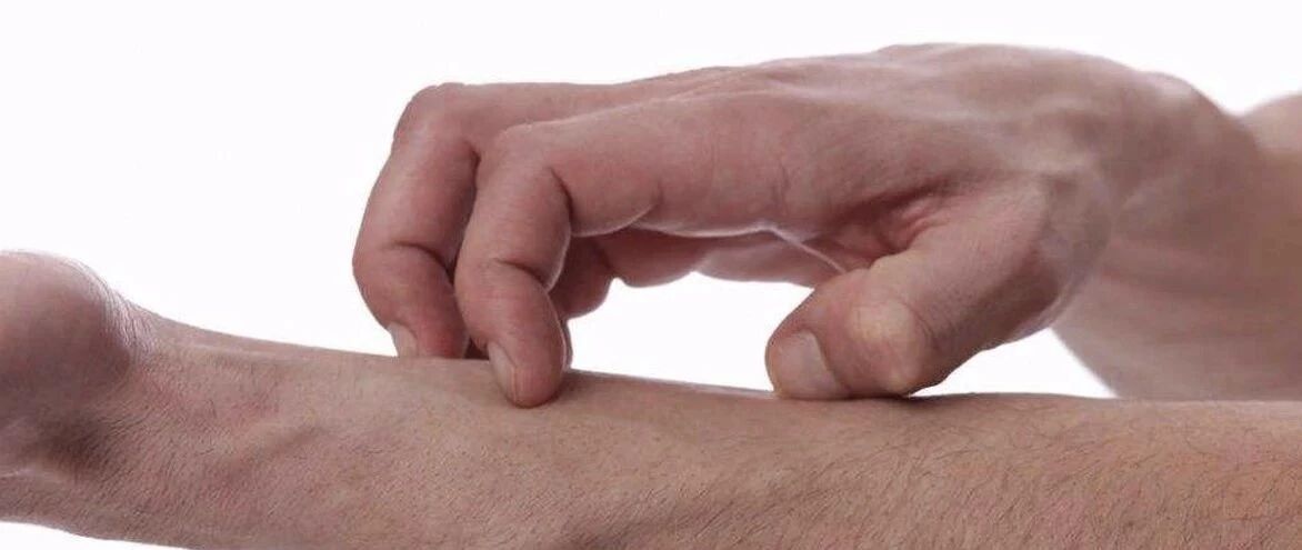 皮肤瘙痒千万别抓！抹它1秒止痒，3天去疹，10年不复发！