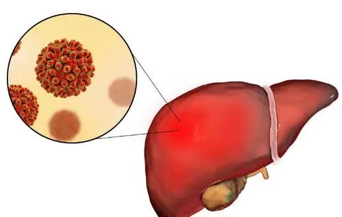 肝好不好，“竖中指”看看是否有3个现象，若没有，那就恭喜了