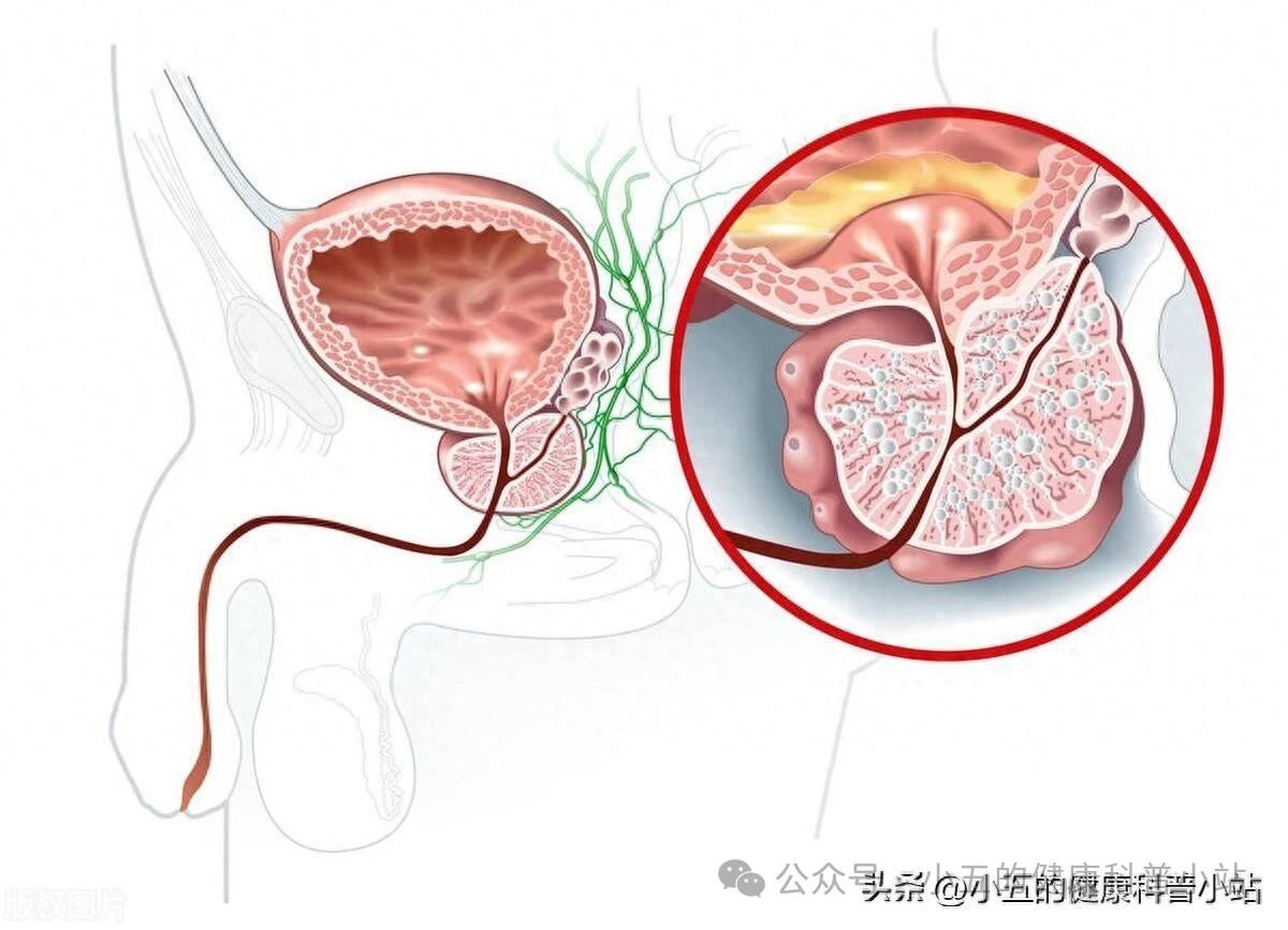 前列舒通胶囊吃多久才能治愈