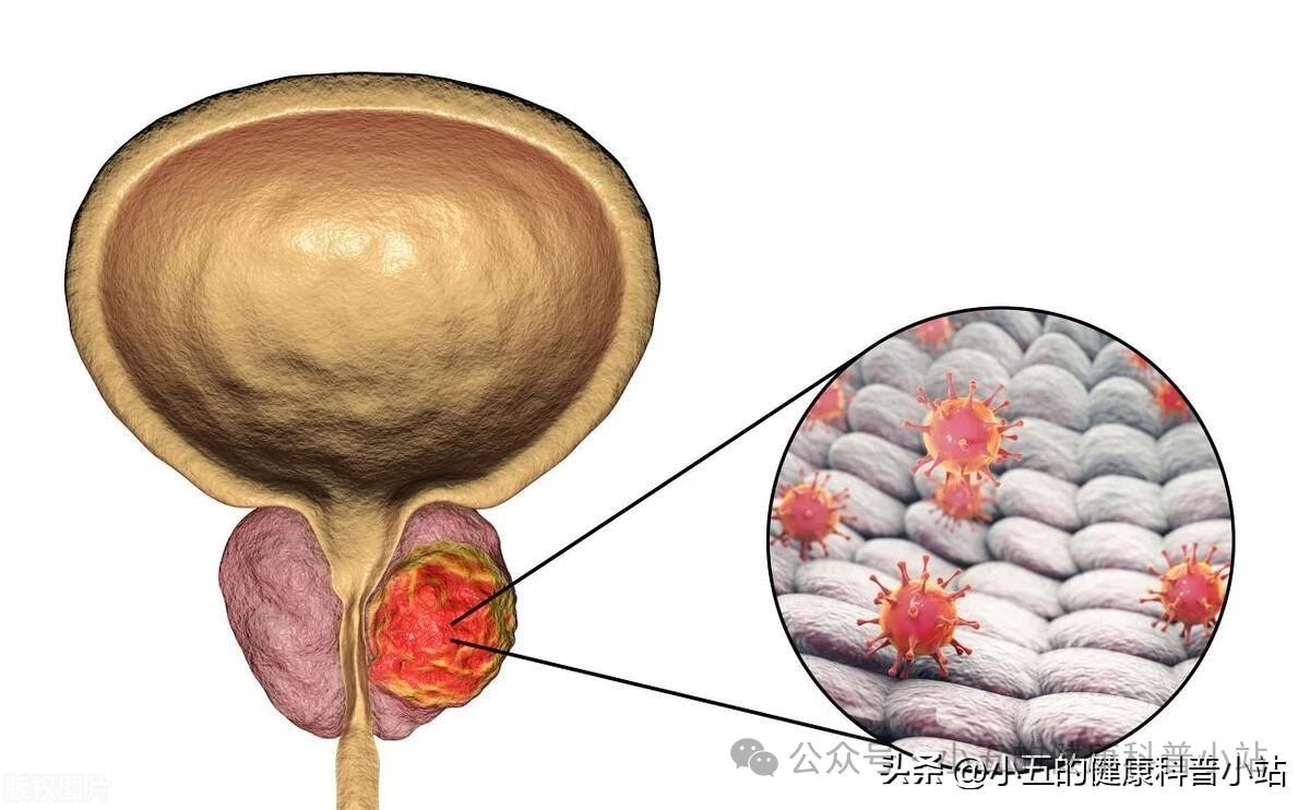 前列舒通胶囊吃多久才能治愈
