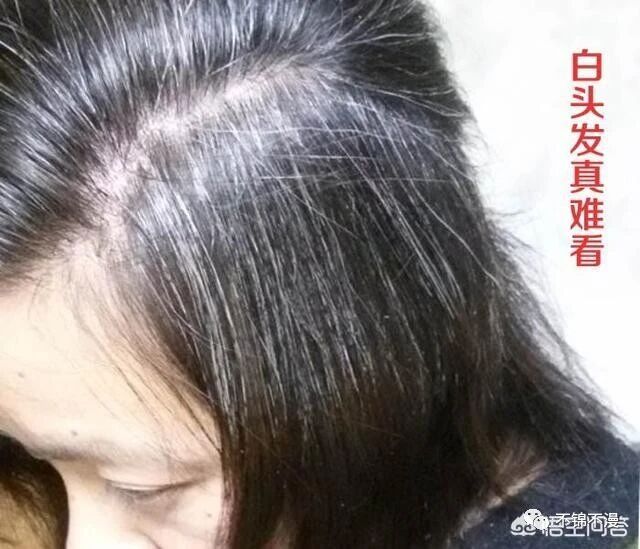 白发每月染一次，对身体有害吗？？？
