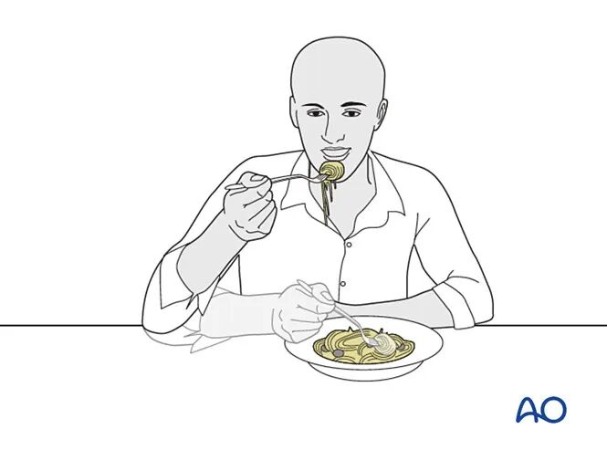 锁骨骨折的术后处理，看看AO怎么做