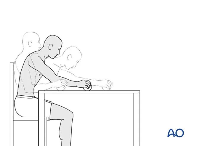 锁骨骨折的术后处理，看看AO怎么做