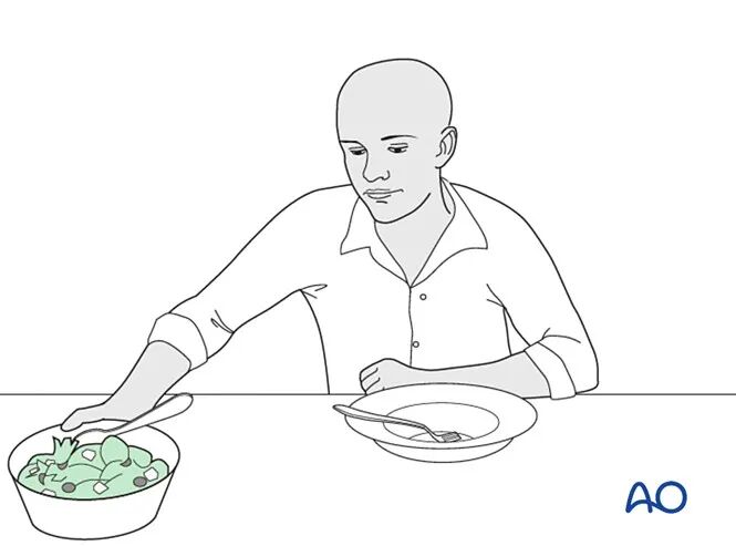 锁骨骨折的术后处理，看看AO怎么做