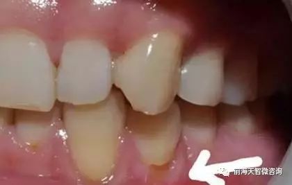 深圳前海天智官网www.tiansense.com医院等级评审管理软件迎检系统|人事管理软件|HRP管理系统|办公OA管理系统|医院耗材管理系统
