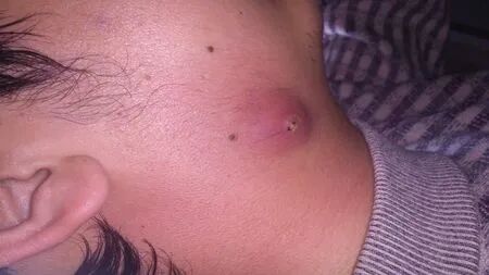 致命！这2个动作或让血栓瞬间脱落，堵塞血管！专家紧急叫停！