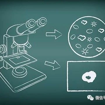 难以抉择！白血病该不该移植？