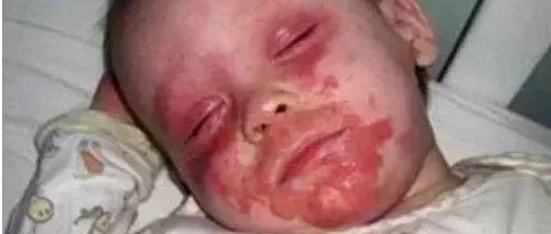 痛心！一个鸡蛋害了4岁孙子，家里有孩子的快看!