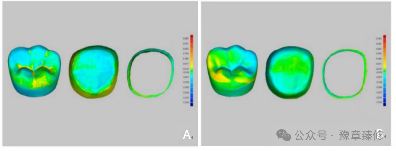 浅谈短冠磨牙的修复策略与方法