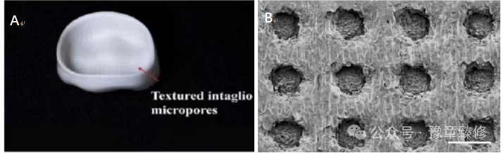 浅谈短冠磨牙的修复策略与方法