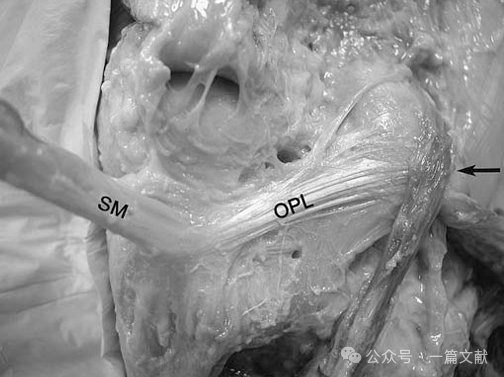膝关节后外侧复合体