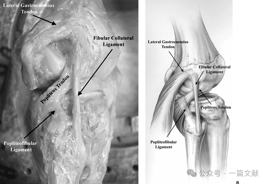 膝关节后外侧复合体