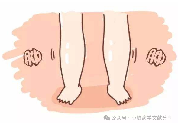 长期服用钙通道阻滞剂降压药致脚踝水肿的干预