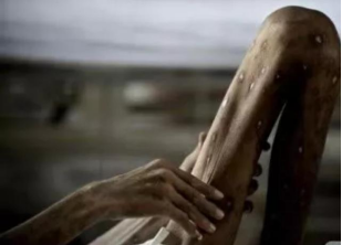 【禁毒宣传】毒品的危害——珍爱生命 远离毒品