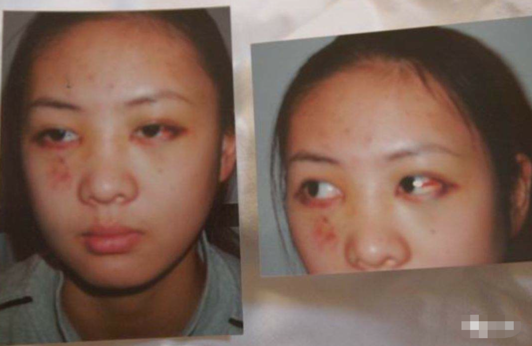 张默谈童瑶：我打她是有原因的，如果换成你们肯定比我打的狠~！
