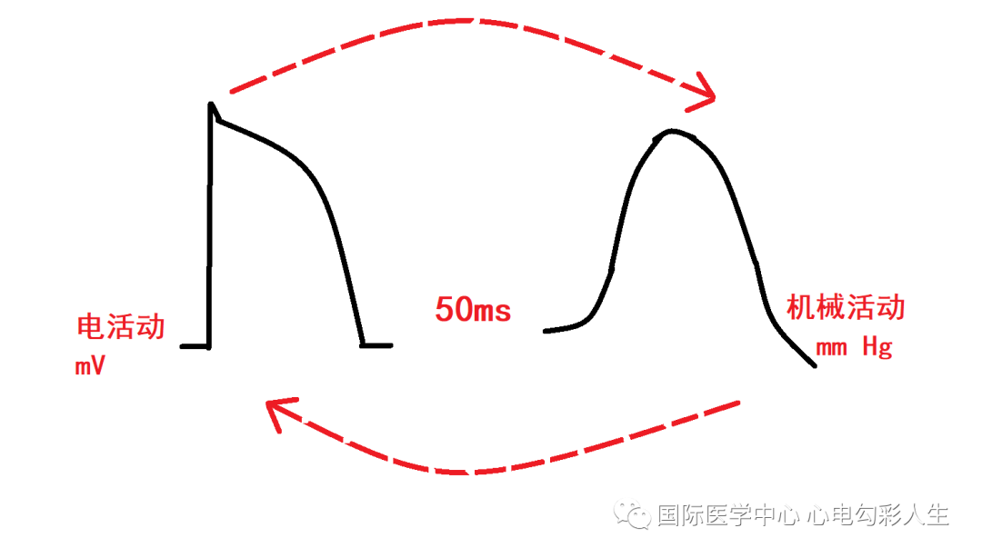 心电图如何报告死亡与濒死心电图​诊断